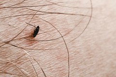 Animal Fleas on Human Hair: Can They Really Live There?