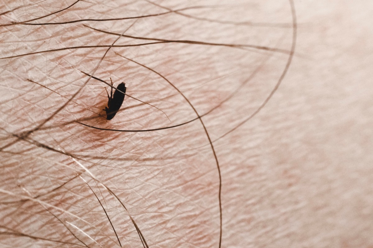 Animal Fleas on Human Hair: Can They Really Live There?
