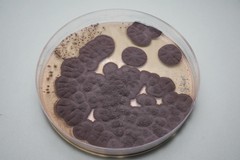 Is Brown Mold Dangerous and What You Should Know